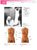 Sobotta  Atlas of Human Anatomy  Trunk, Viscera,Lower Limb Volume2 2006, page 139